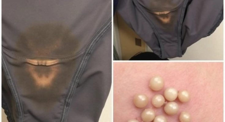 BE CAREFUL, If you spot these dots on your skin, it means you have Can…Read more